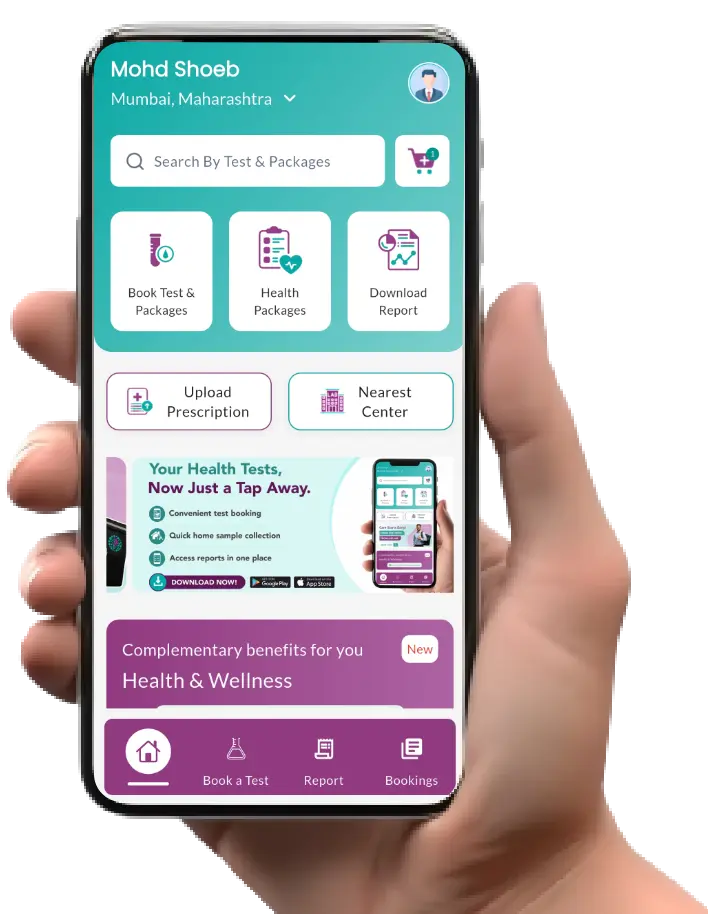 Mobile App